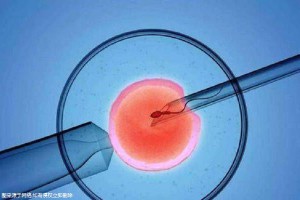 代生包成功代妈补偿